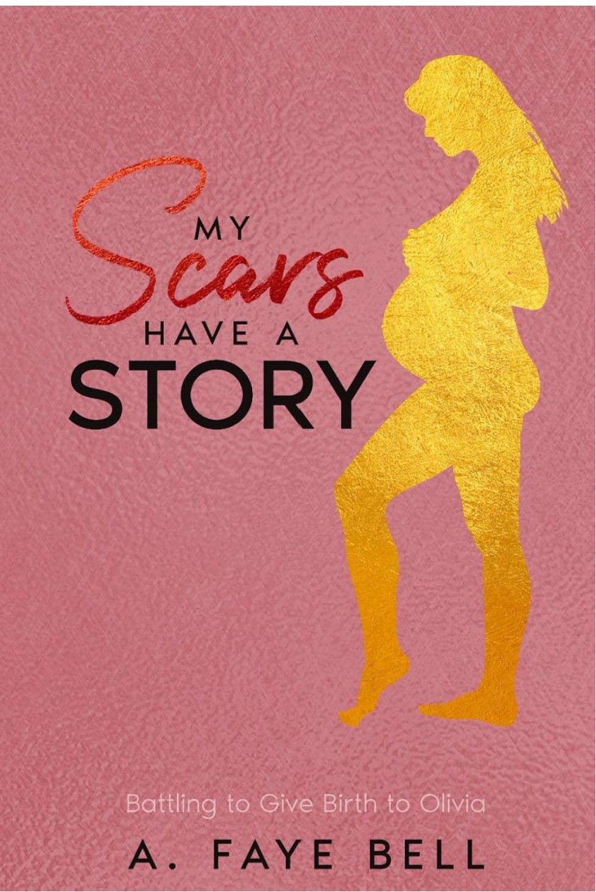 My Scars Have A Story by A. Faye Bell — book cover